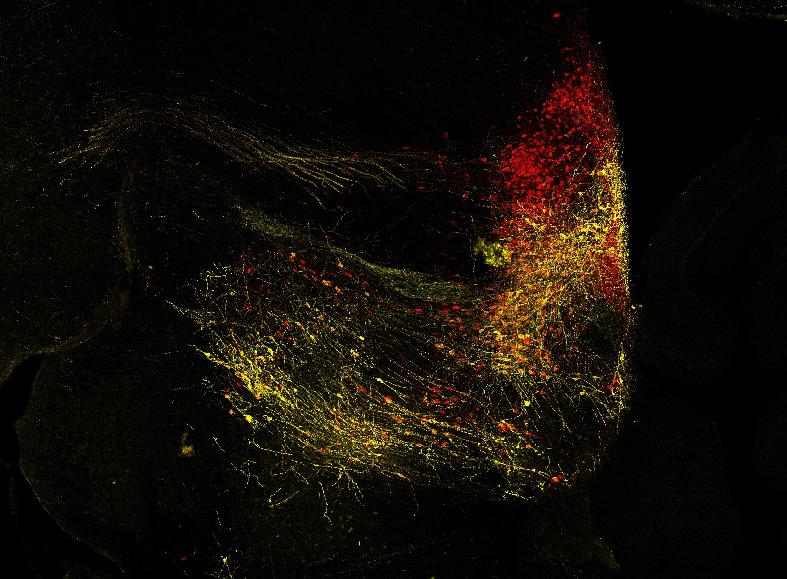 A microscopy image showing neural connections in yellow and red, against a black background.