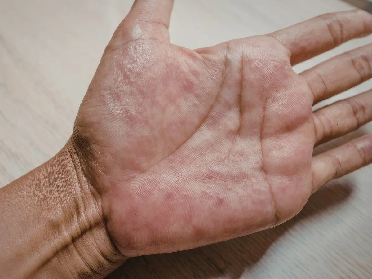 Skin Issues &amp; Hair Changes