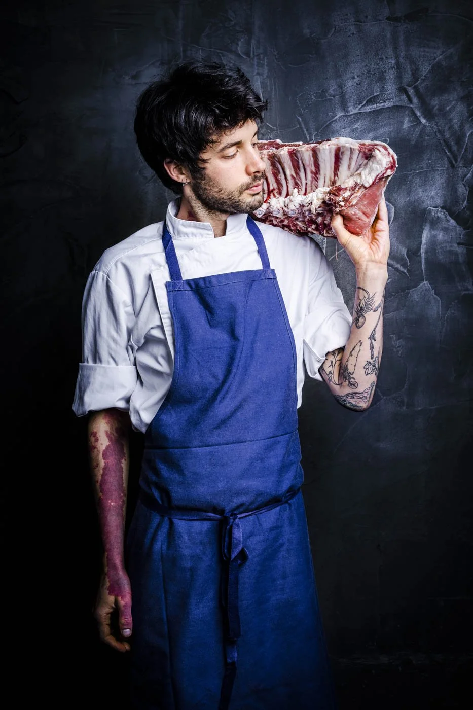 Delphine-Constantini-alexis-jaouis-viande-vitiligo
