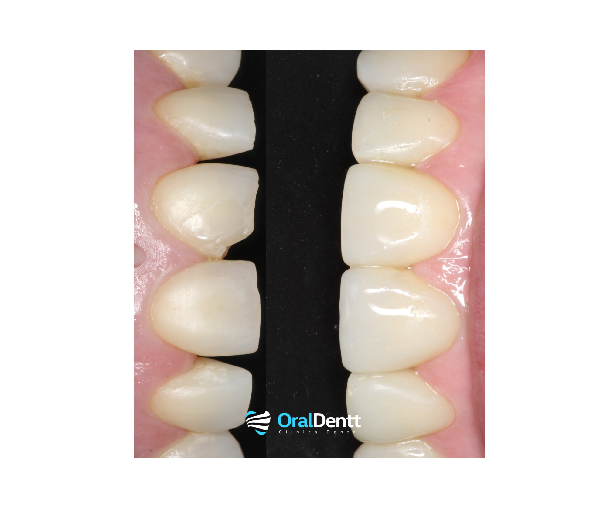 Estetica dental