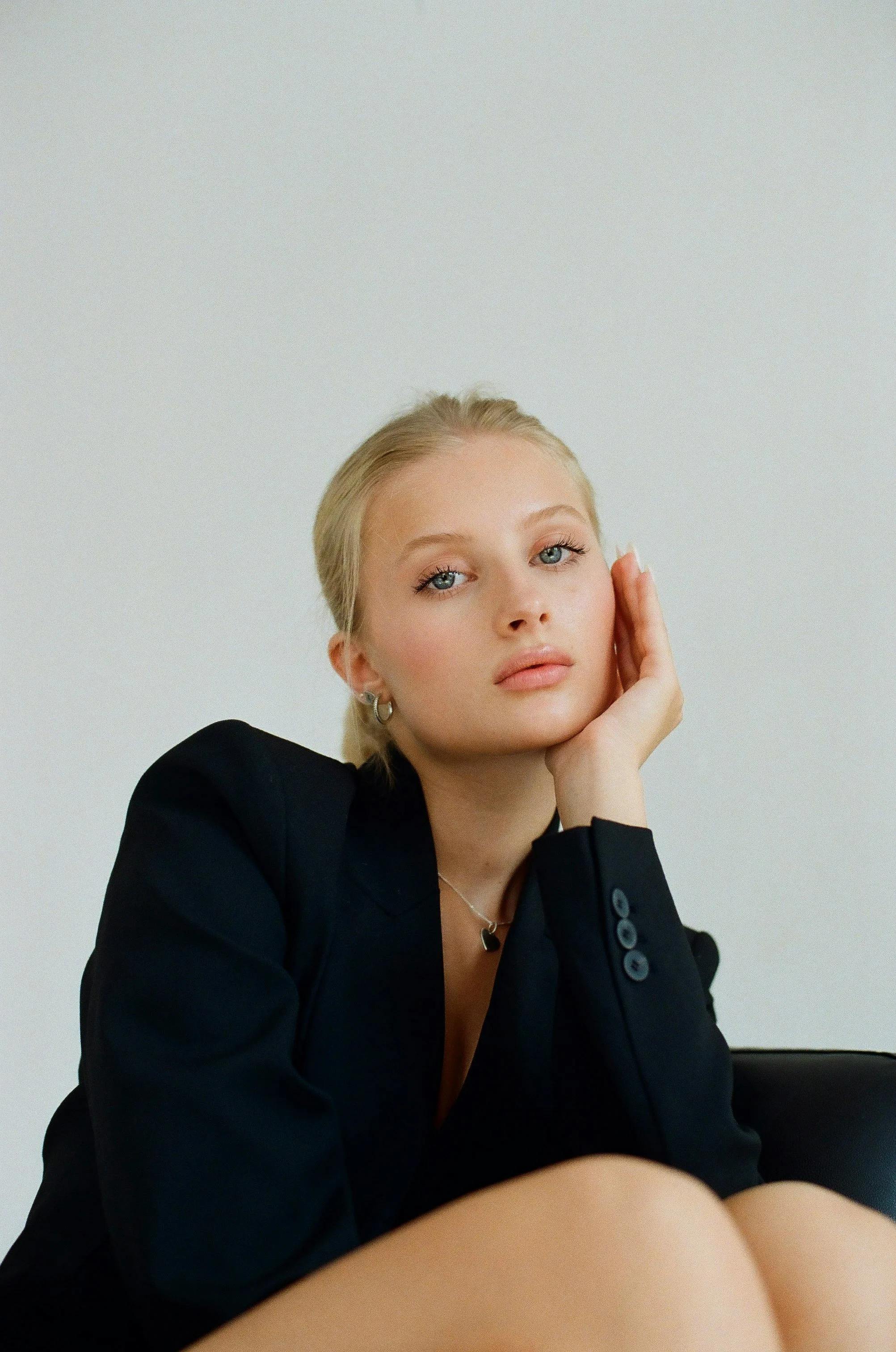 Woman with clear skin resting hand on face — Profhilo bio-remodelling treatment at Skinor, Chelsea SW3