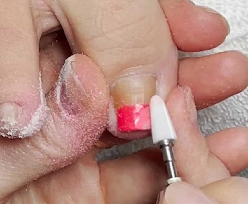 Step 1 remove nail polish before applying Restore A Nail