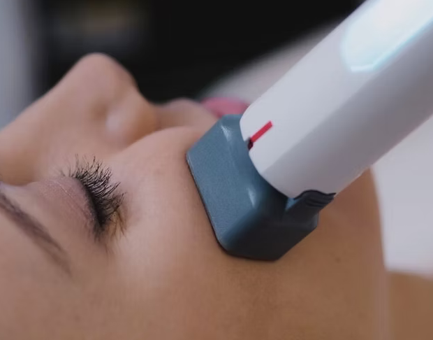 Cynosure Lutronic XERF