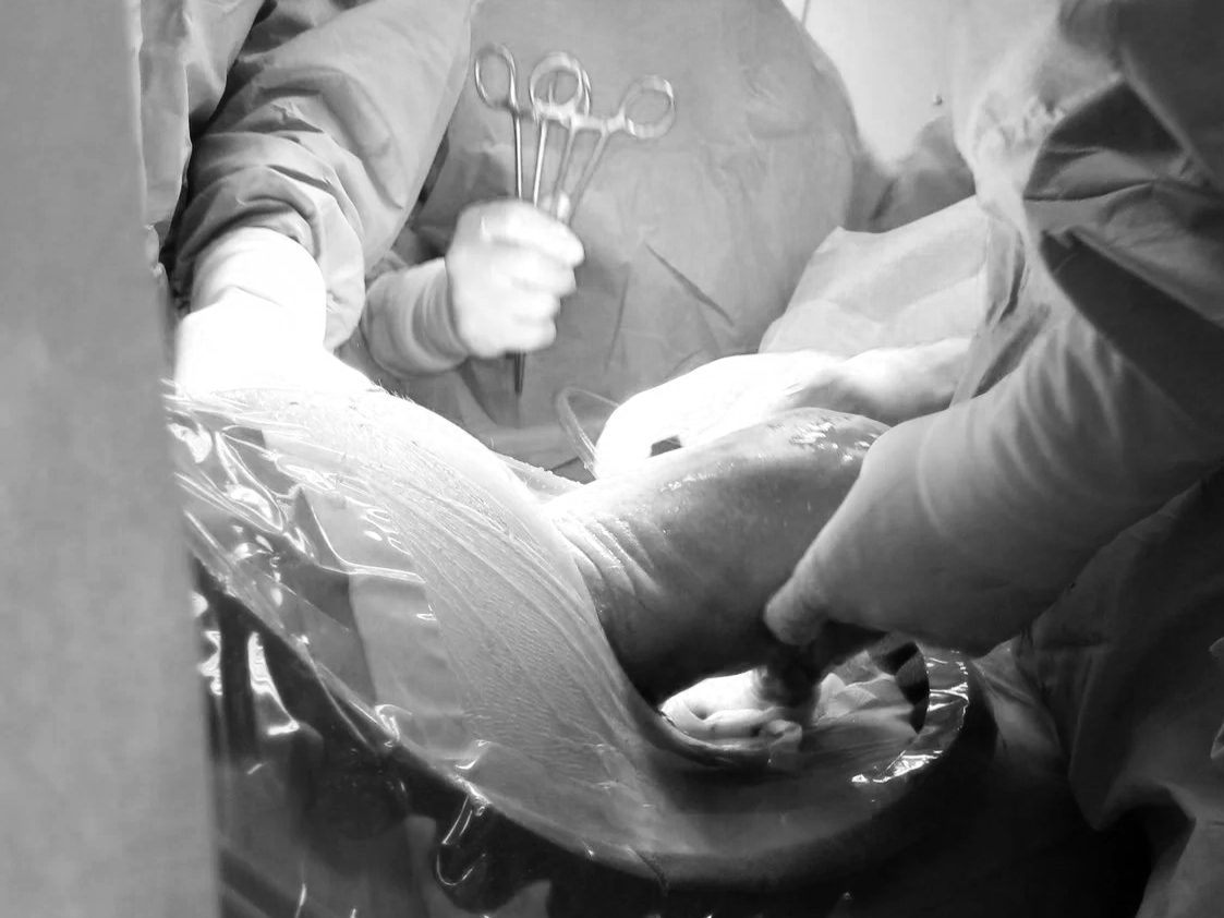 What I Know About Caesarean Birth — From Both Sides of the Camera