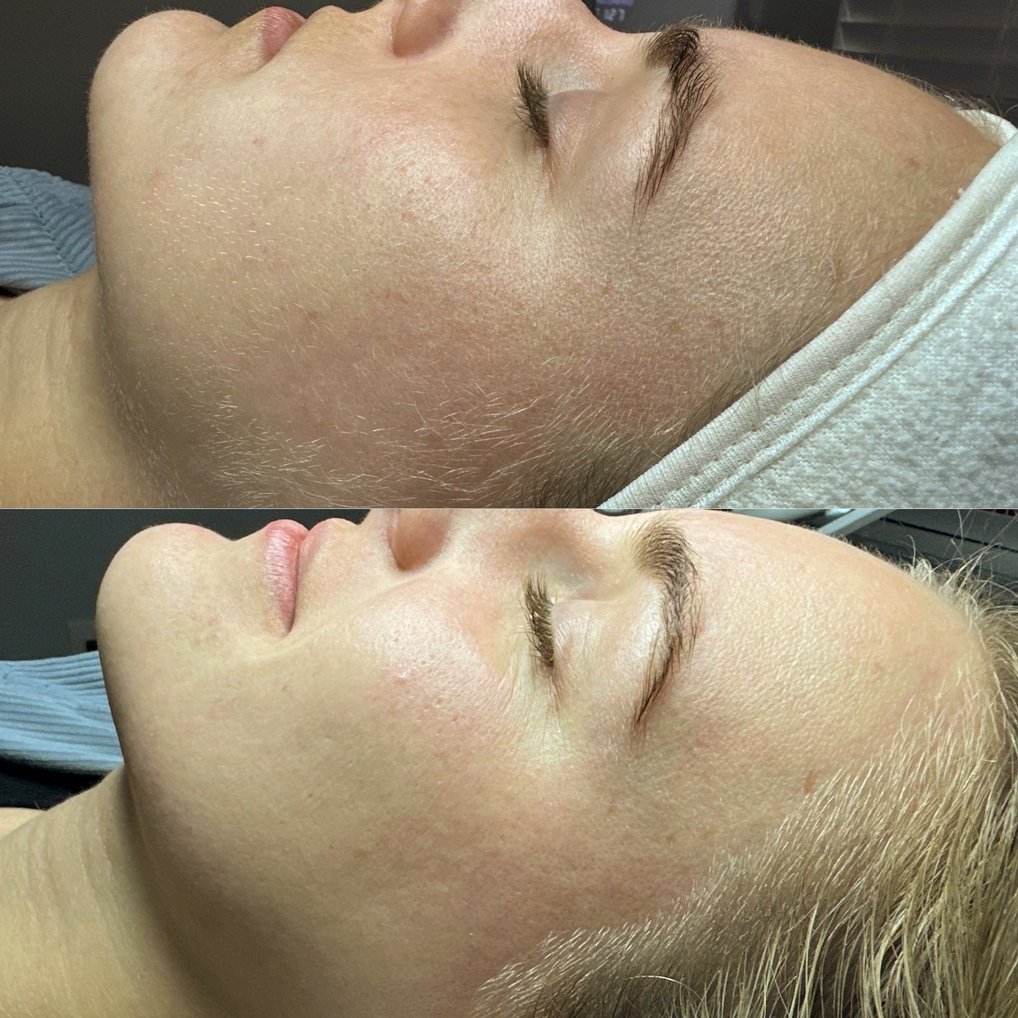 Close-up of a person's face with closed eyes, light skin, and light-colored eyebrows, lying down on a surface.