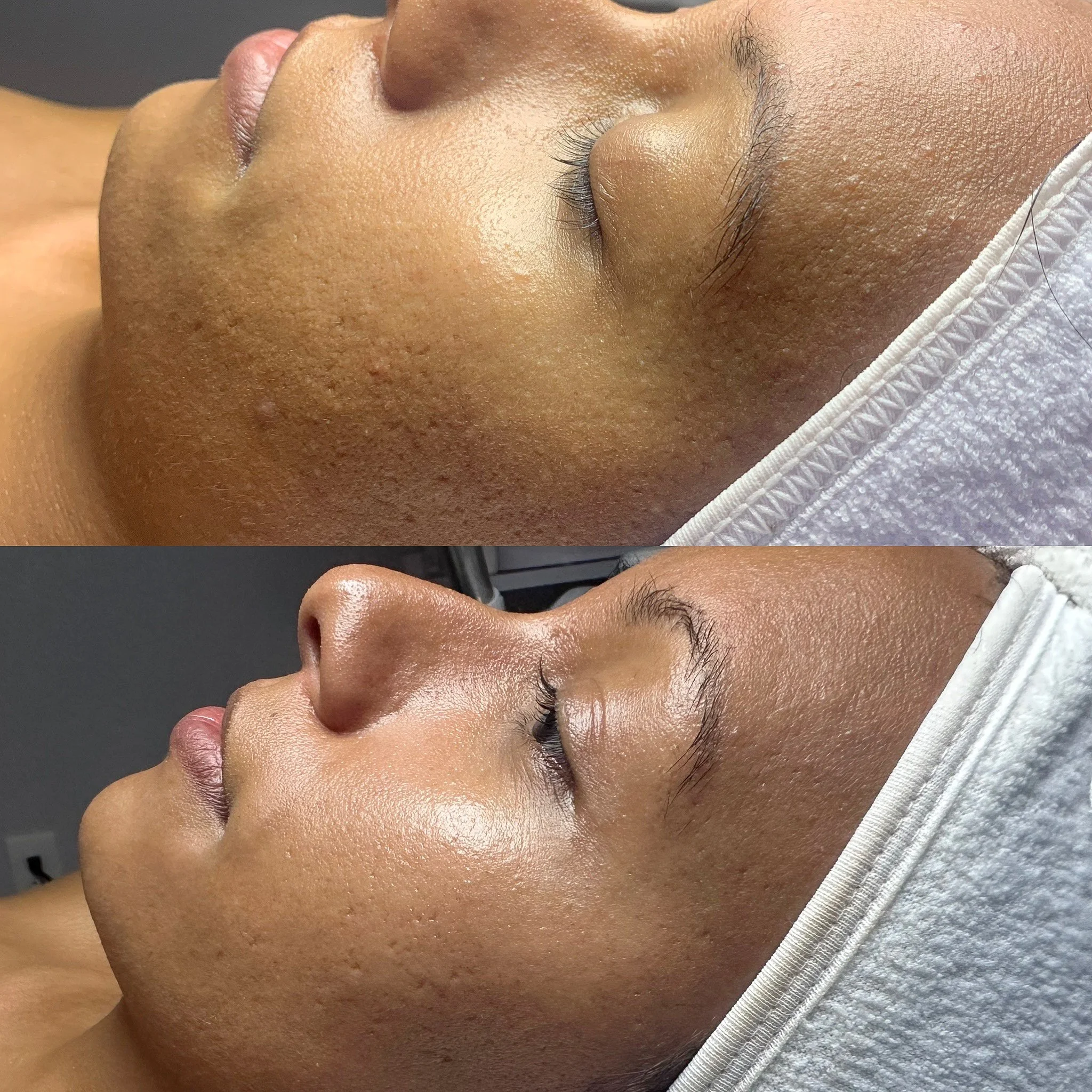 Close-up of a person's face showing nose, eyelashes, and skin texture.