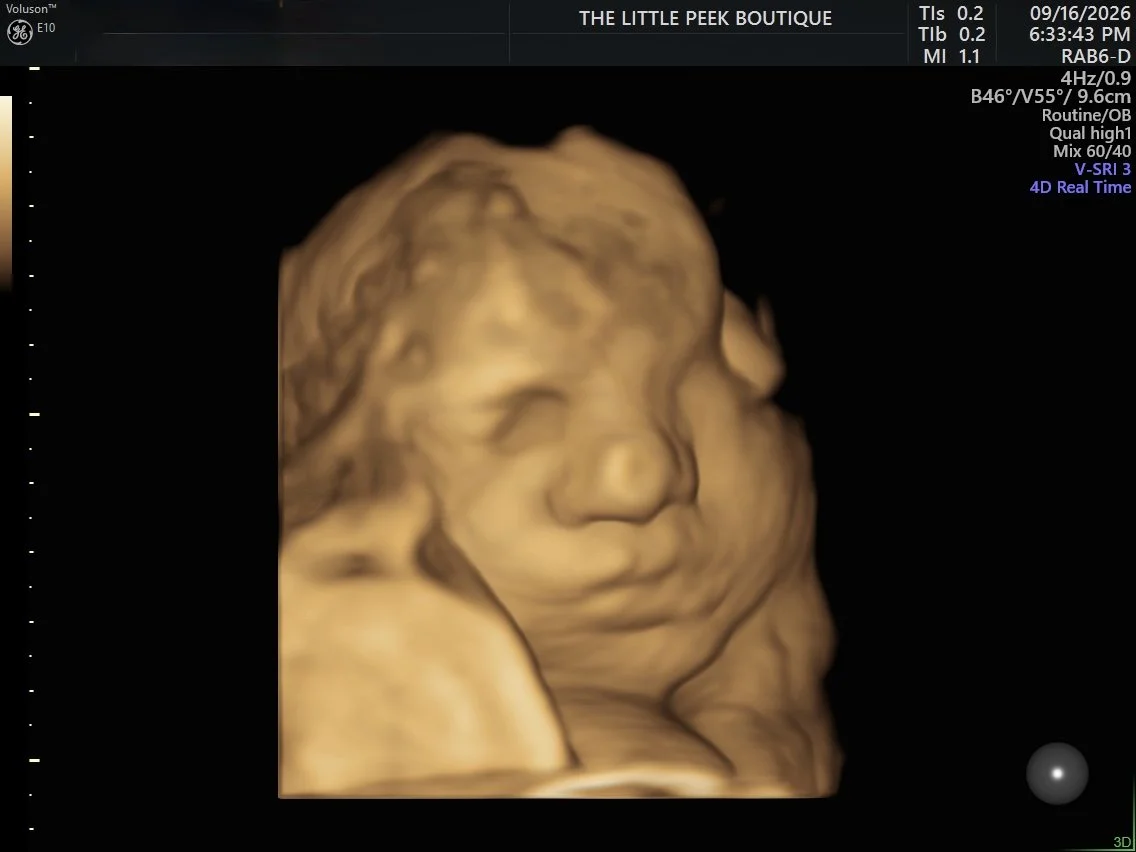 3D ultrasound image of a baby's face.