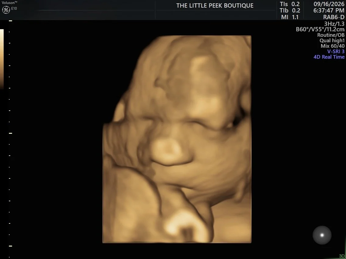 3D ultrasound image of a developing fetus in the womb.