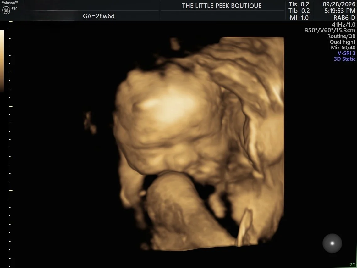 A 3D ultrasound image of a fetus at approximately 28 weeks gestation, showing the fetus's face and hand.