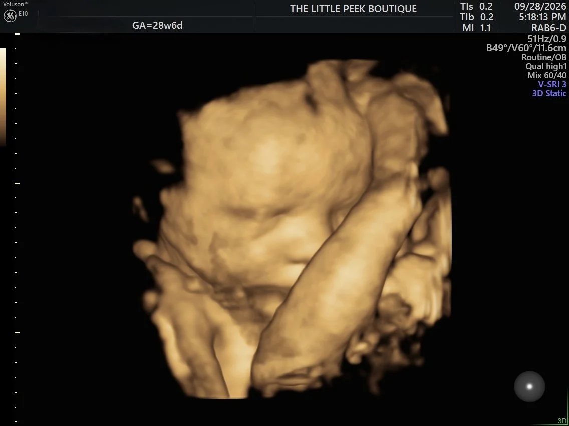 3D ultrasound image of a fetus at 28 weeks and 6 days of pregnancy, showing the head and face in detail.