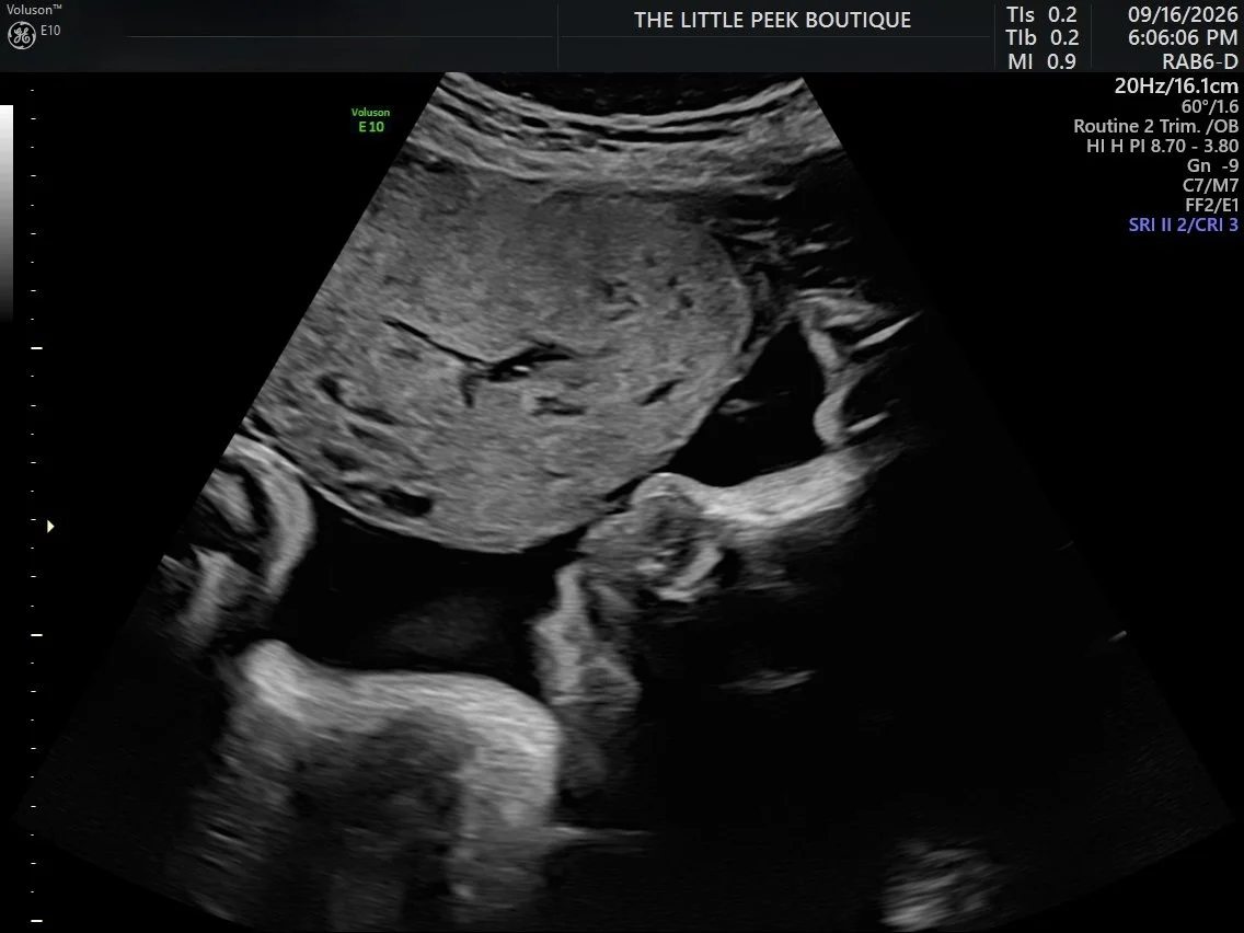 Ultrasound image of a fetus in the womb, showing the head, body, and limbs.