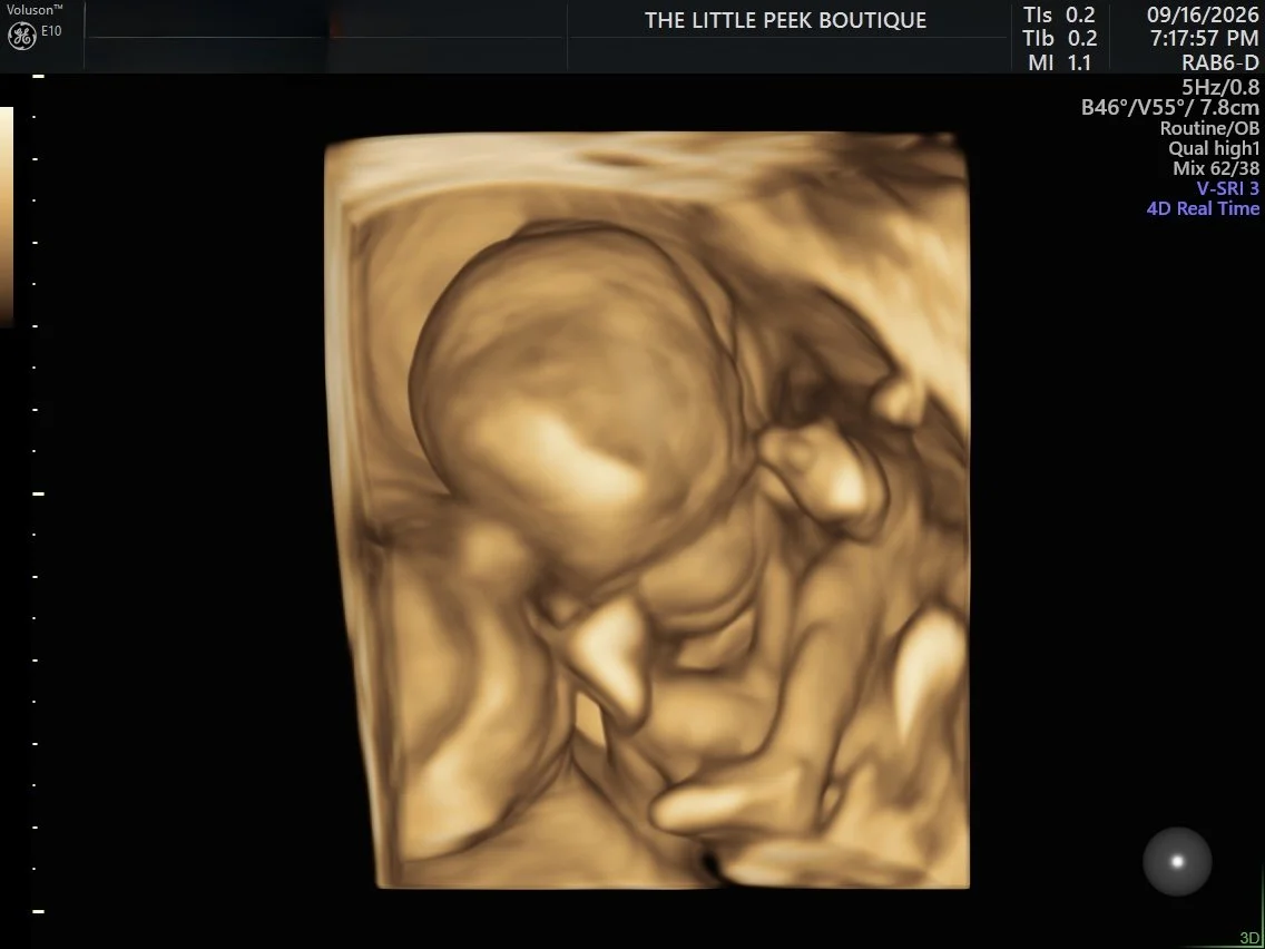 3D ultrasound image of a fetus in the womb, showing the head, face, and hands in profile view.