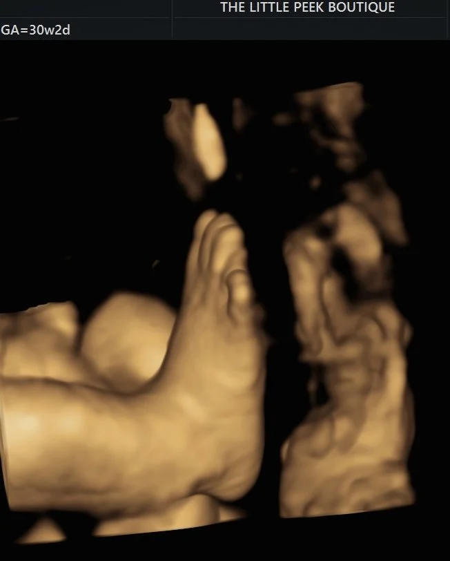 A 3D ultrasound image of a baby in the womb, showing the face and hands.