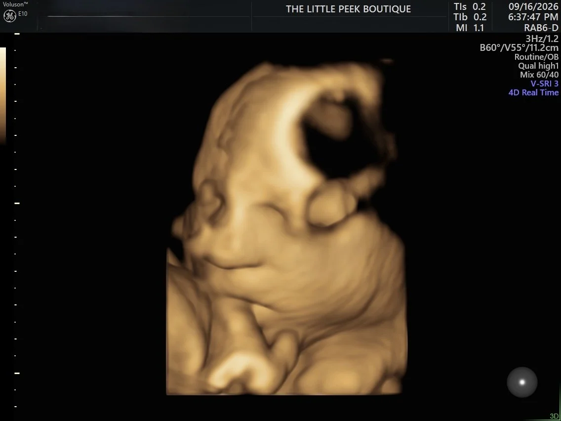 3D ultrasound image of a fetus showing facial features and part of the head.