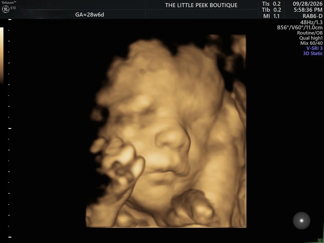 A 3D ultrasound image of a fetus showing facial features and hand near the face.