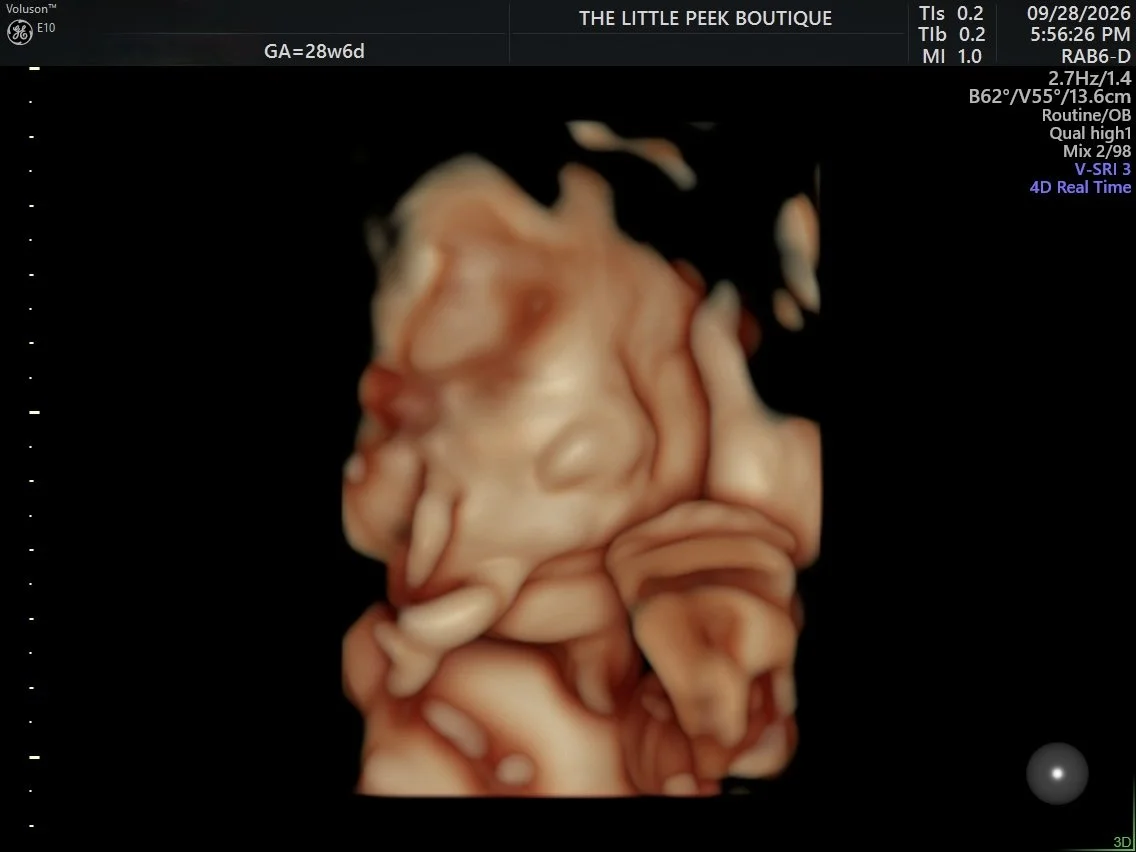 3D ultrasound image of a developing fetus at 28 weeks and 6 days gestation.