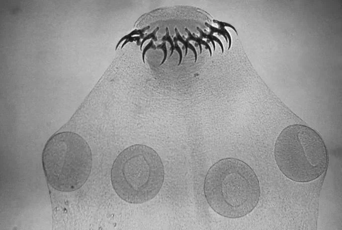 Taenia_solium_tapeworm_scolex_with_its_four_suckers_and_two_rows_of_hooks_5262_lores copy.jpg