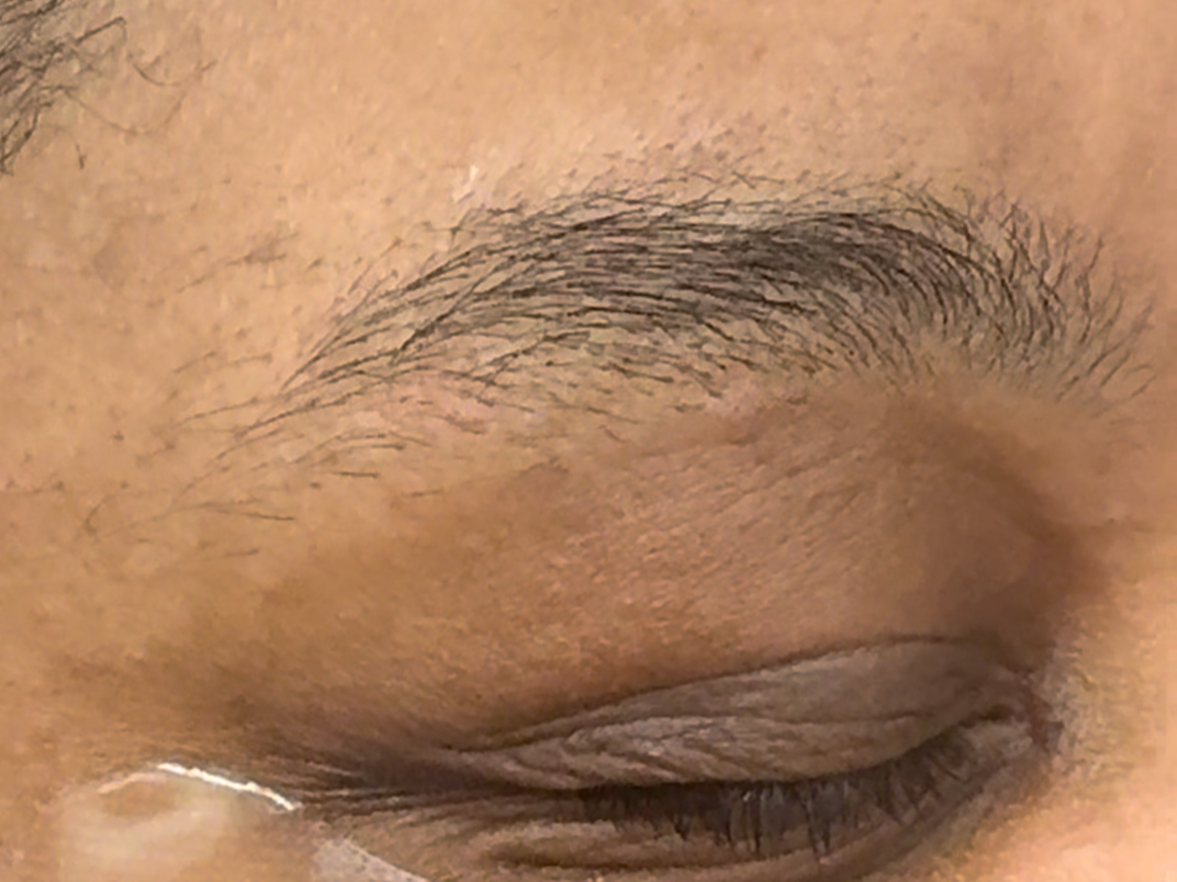 Before: Natural Brows