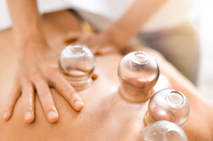 Person receiving cupping therapy with four glass cups on their back.