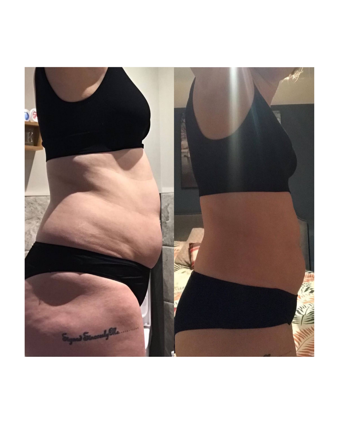 A side-by-side comparison of a woman's midsection before and after weight loss, showing reduction in body fat and improved muscle tone.