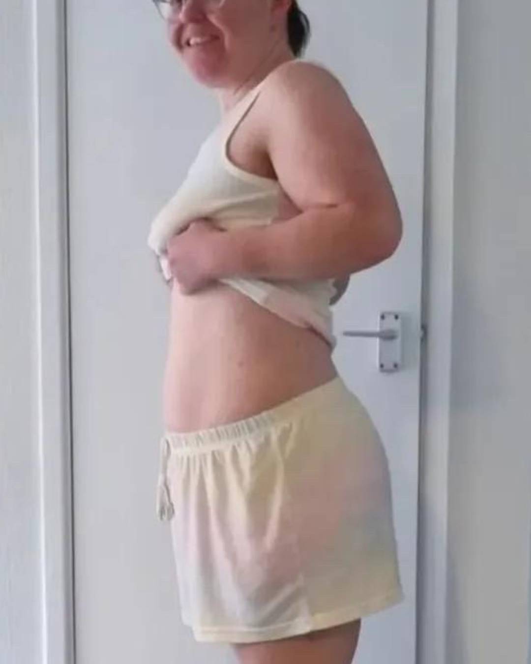 Woman before and after weight loss