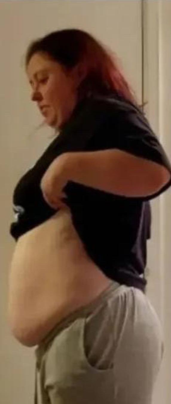 Woman before and after weight loss