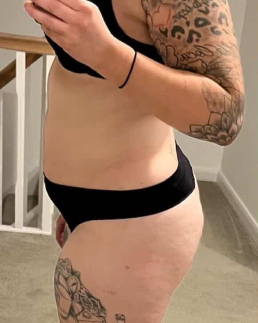 Woman before and after weight loss