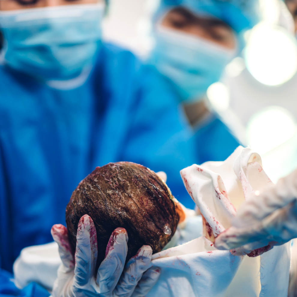 Giving Birth in Zurich: Why Preparation Matters