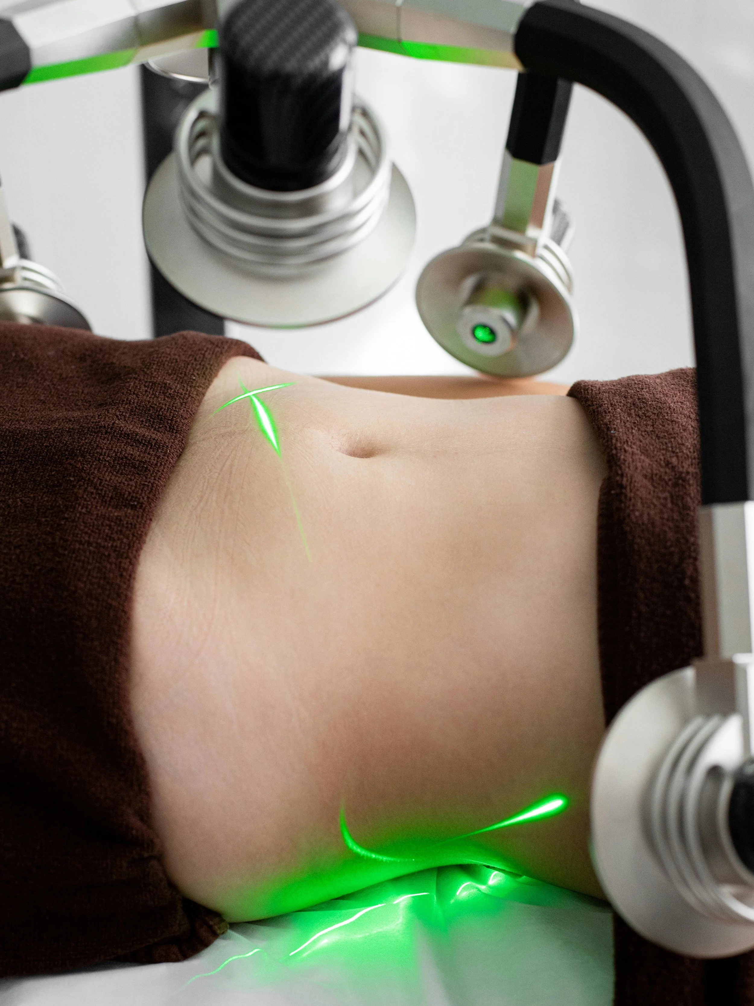 Medical laser device emitting green laser beam on a patient's ankle during treatment in a clinical setting.