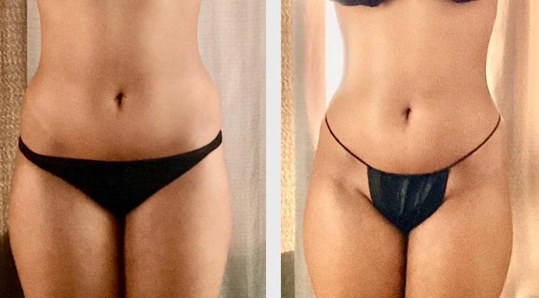 Side-by-side comparison of a woman's midsection before and after a change, showing her wearing minimal underwear in both images.
