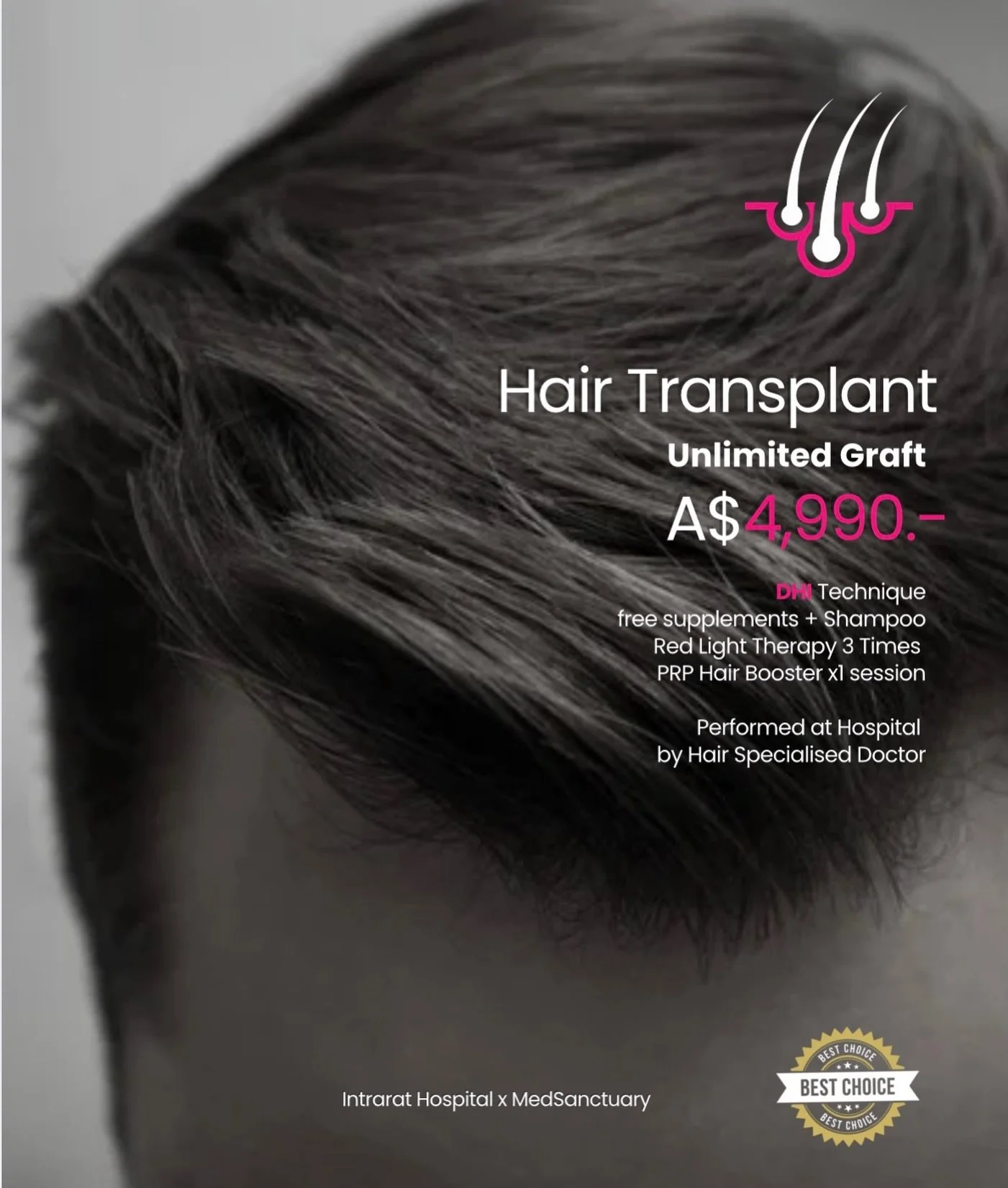 ✨Restore your hairline at a world-class hospital in Bangkok.
DHI (Direct Hair Implantation) is one of the most advanced hair restoration techniques available today. Using a specialised Choi implanter pen, follicles are placed directly &mdash; no line
