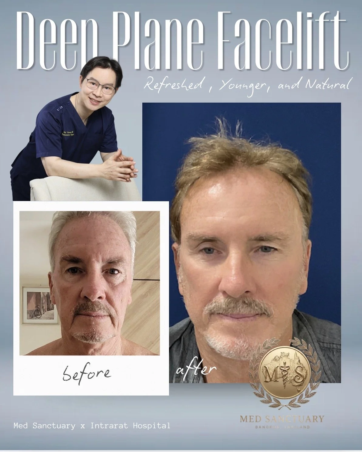 The image shows a promotional advertisement for a treatment at Med Sanctuary in Bangkok, Thailand. It features a woman in a navy blue uniform smiling and leaning on an armrest, and a large before-and-after comparison of a man's face, showing a signif