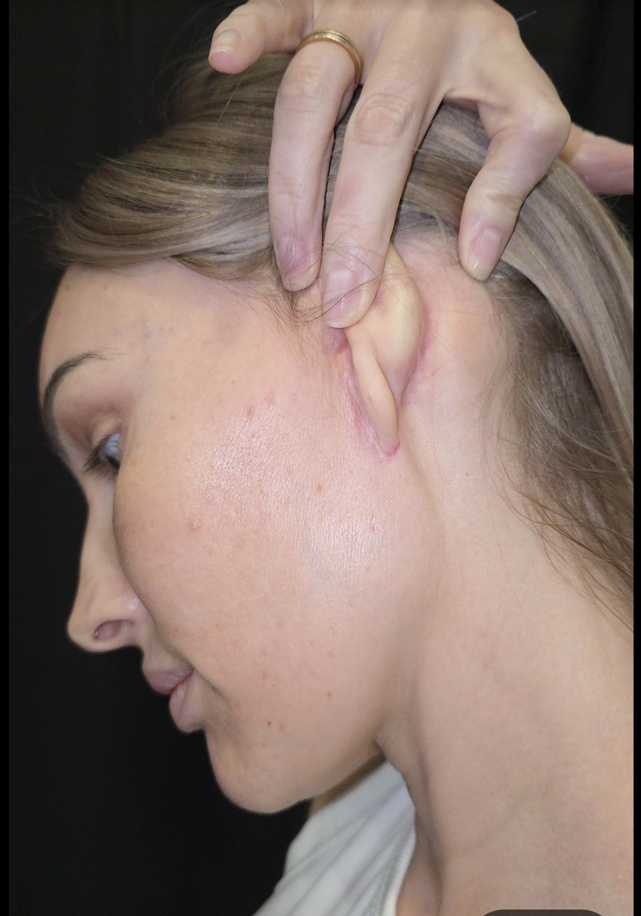 A person receiving an ear massage or ear cleaning from a therapist with their hand applying gentle pressure on the person's ear.
