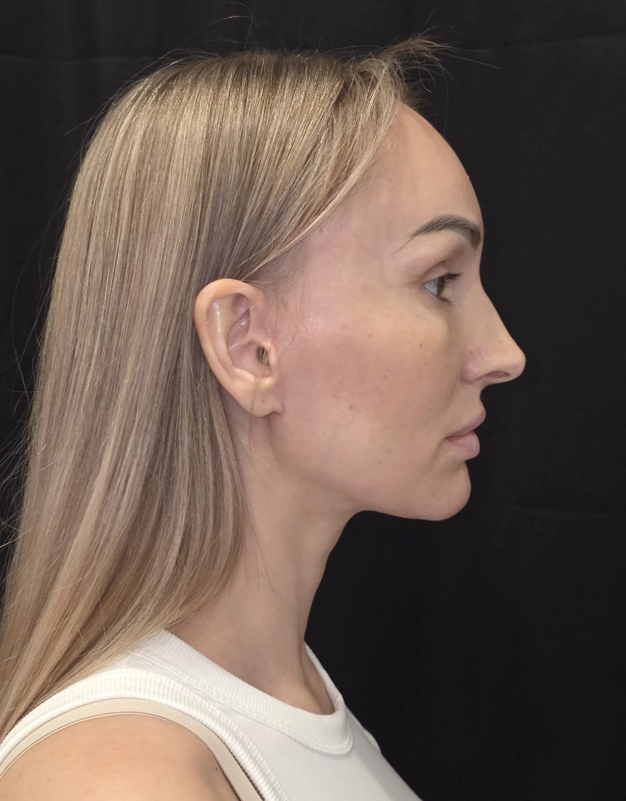 Profile view of a woman with straight blonde hair against a black background.