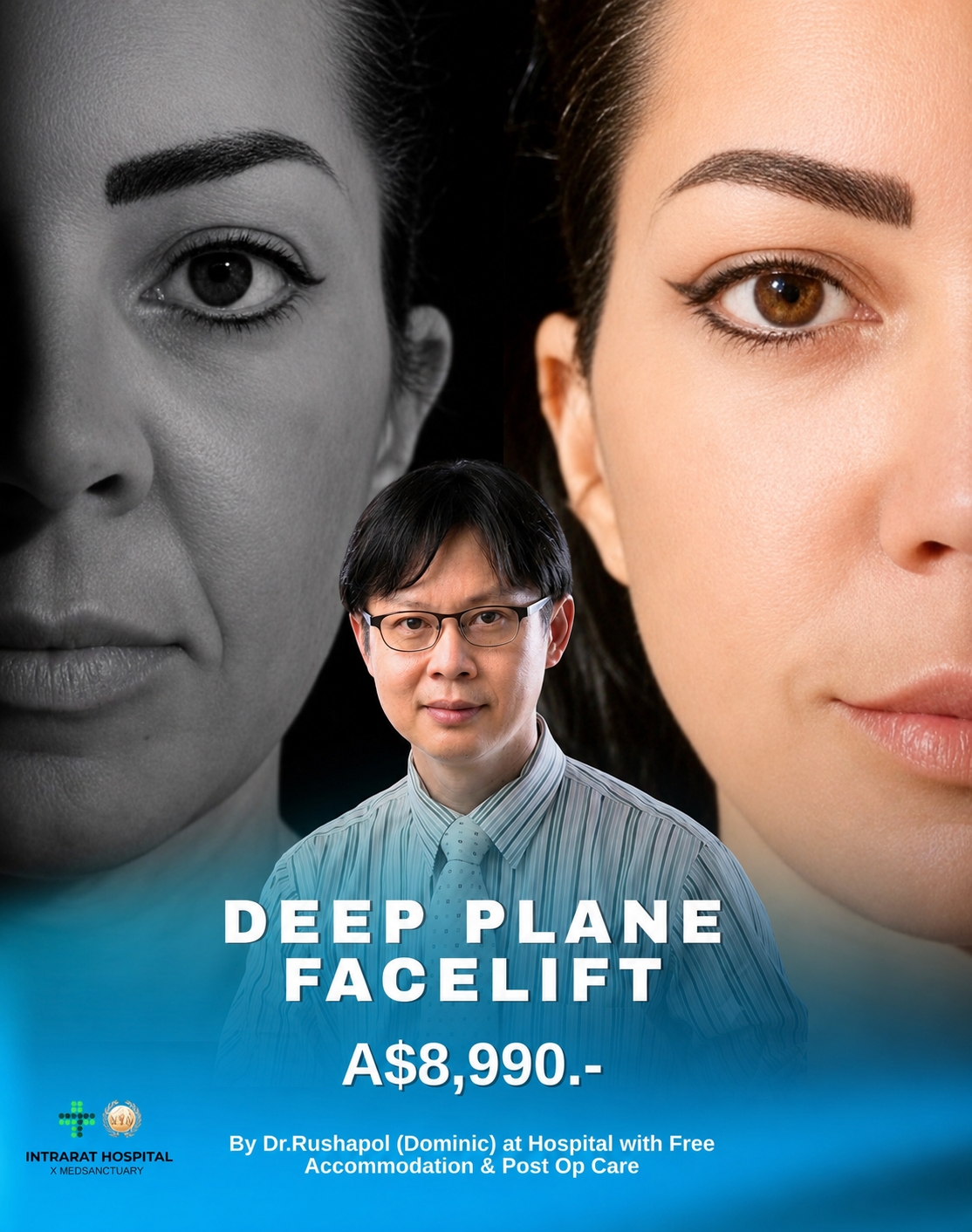 Advertisement for deep plane facelift surgery, showing contrasting black and white and color close-up images of women's faces, and a man in front wearing glasses and a striped shirt.