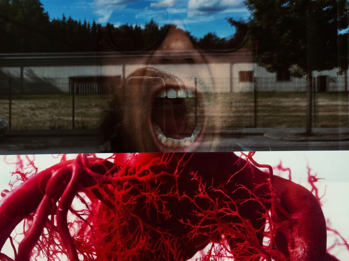 The image shows a reflection of a person with sunglasses and an open mouth in a glass window. Behind the glass, there is a background of a cloudy blue sky and trees. In the lower part of the image, there is a detailed, close-up illustration of red blood vessels and veins.