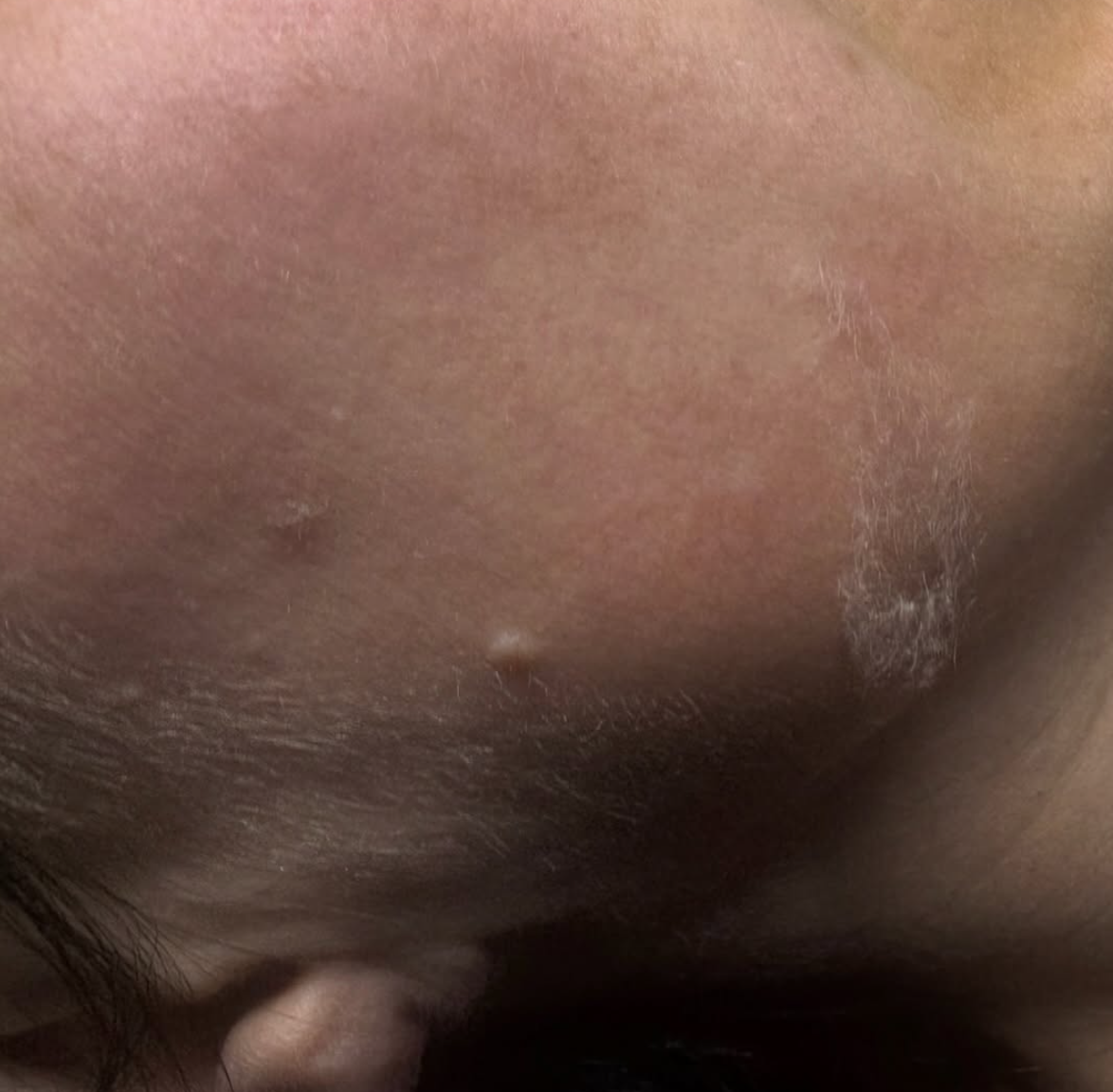Close-up of a person's chin and lower lip area, showing skin texture and facial hair.