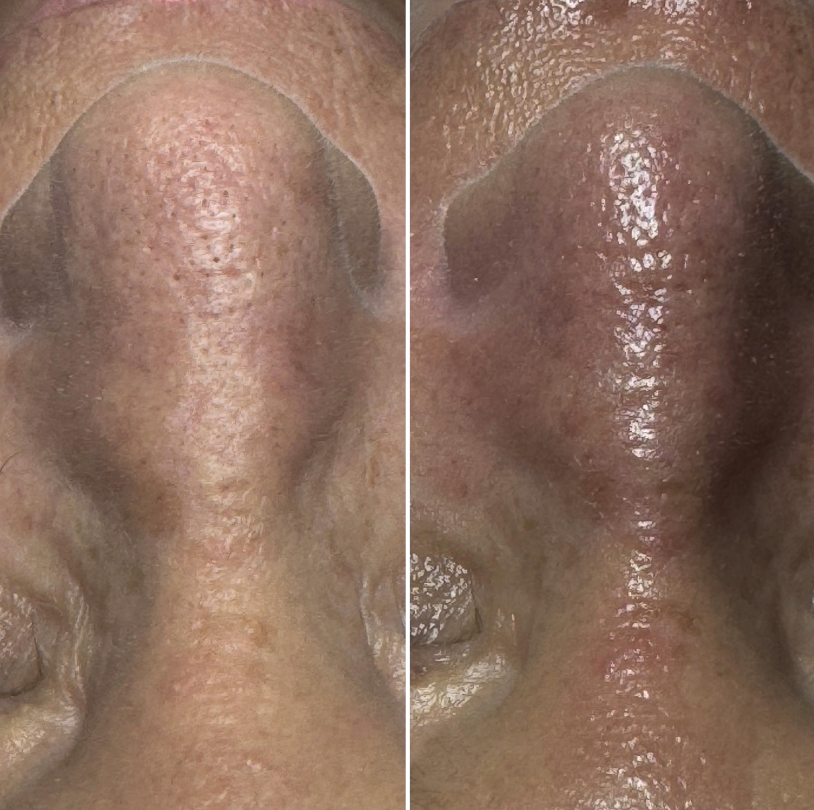 Close-up of human nose, showing skin texture and pores.