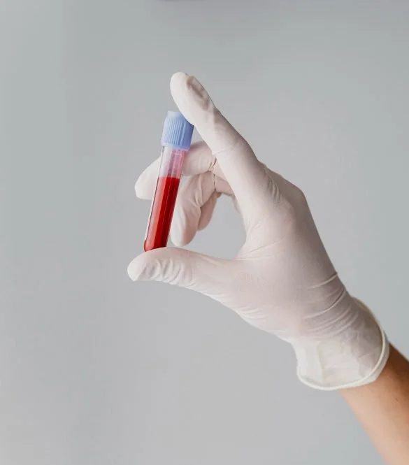 Functional Blood Chemistry Analysis