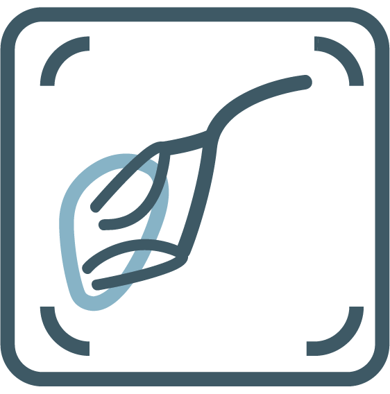 Prostate Artery Embolisation (PAE)
