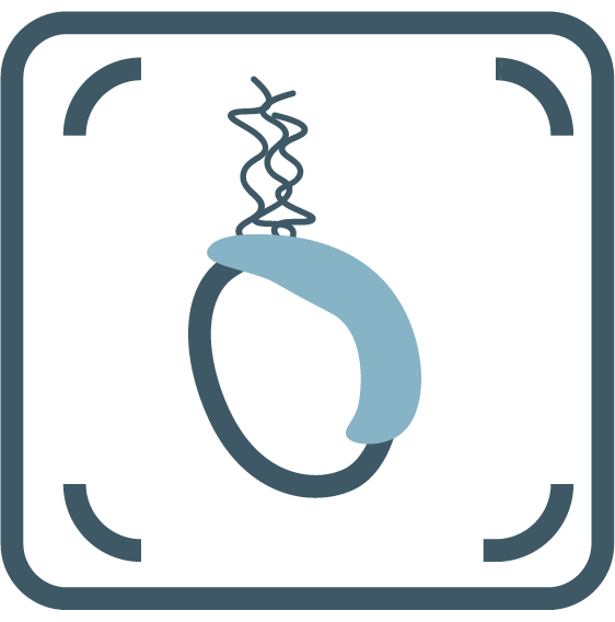 Varicocele Embolisation