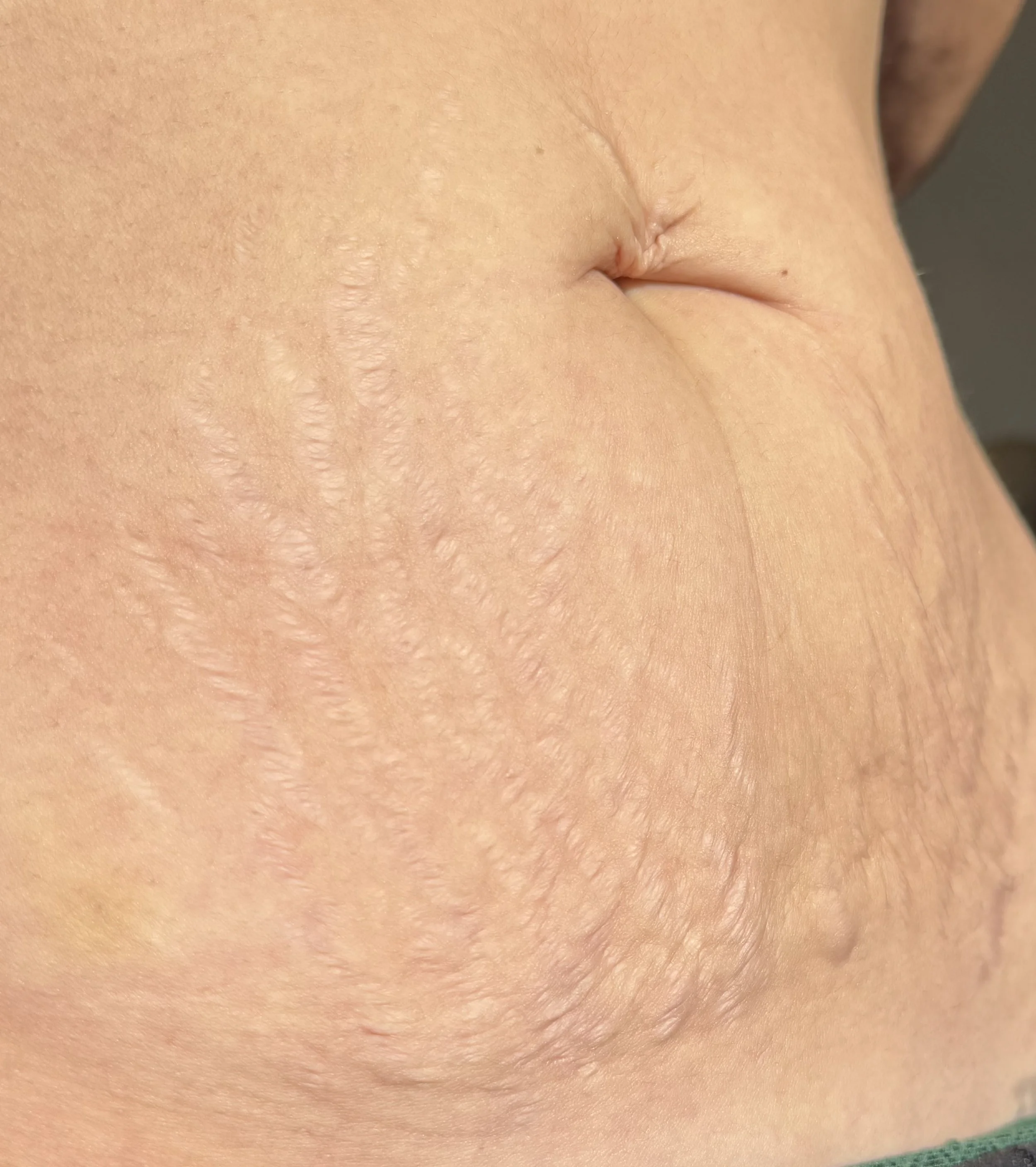 Close-up of skin with fine hair and visible pores, part of a person's body.