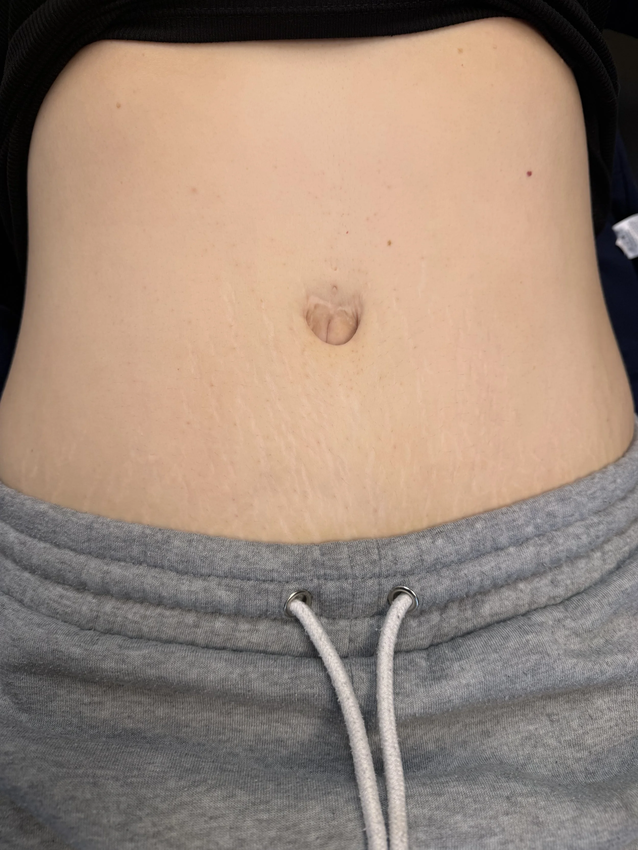 Close-up of a person's bare abdomen with a navel, wearing grey sweatpants with drawstrings.