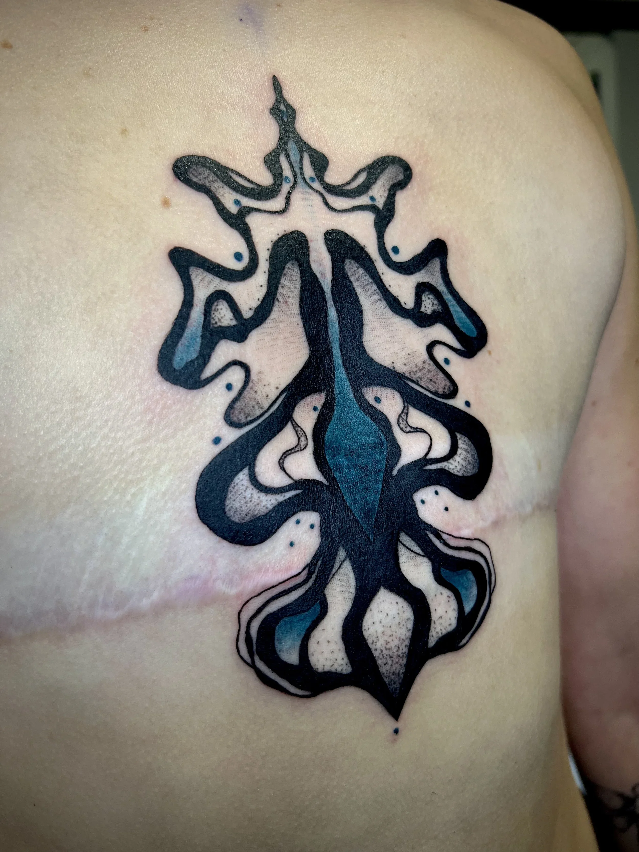 Chest+.webp
