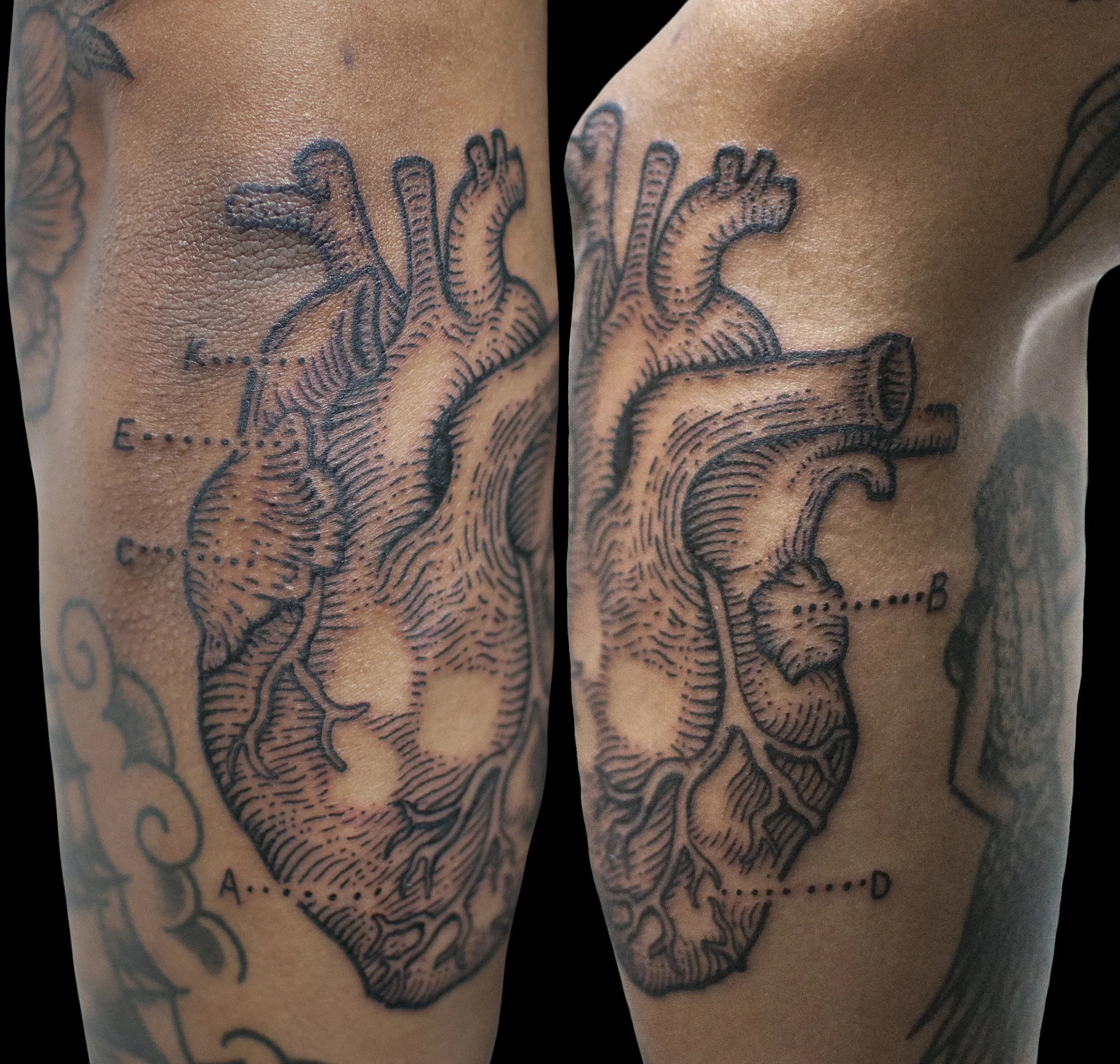 jason_anatomicheart.webp
