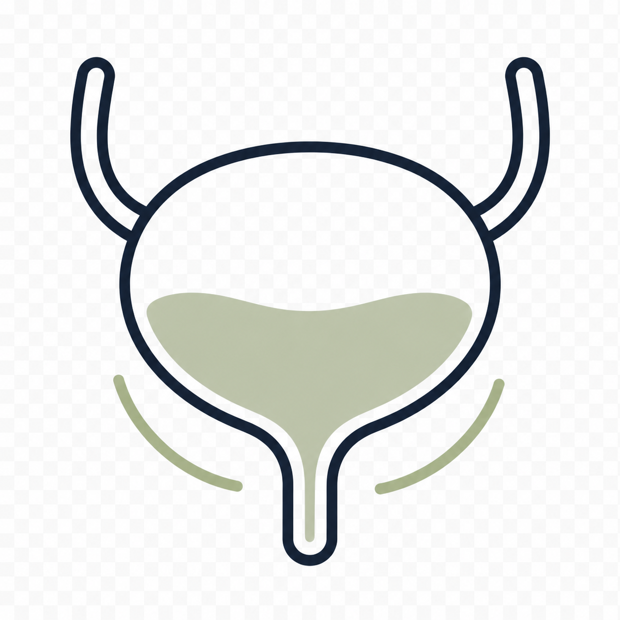 Line drawing of a human urinary bladder with urine inside