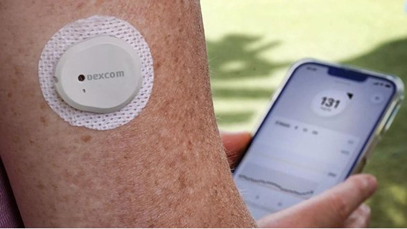 A close-up of a person's arm with a Dexcom continuous glucose monitor attached, and a smartphone displaying a glucose level of 131 and a trend graph in the background.