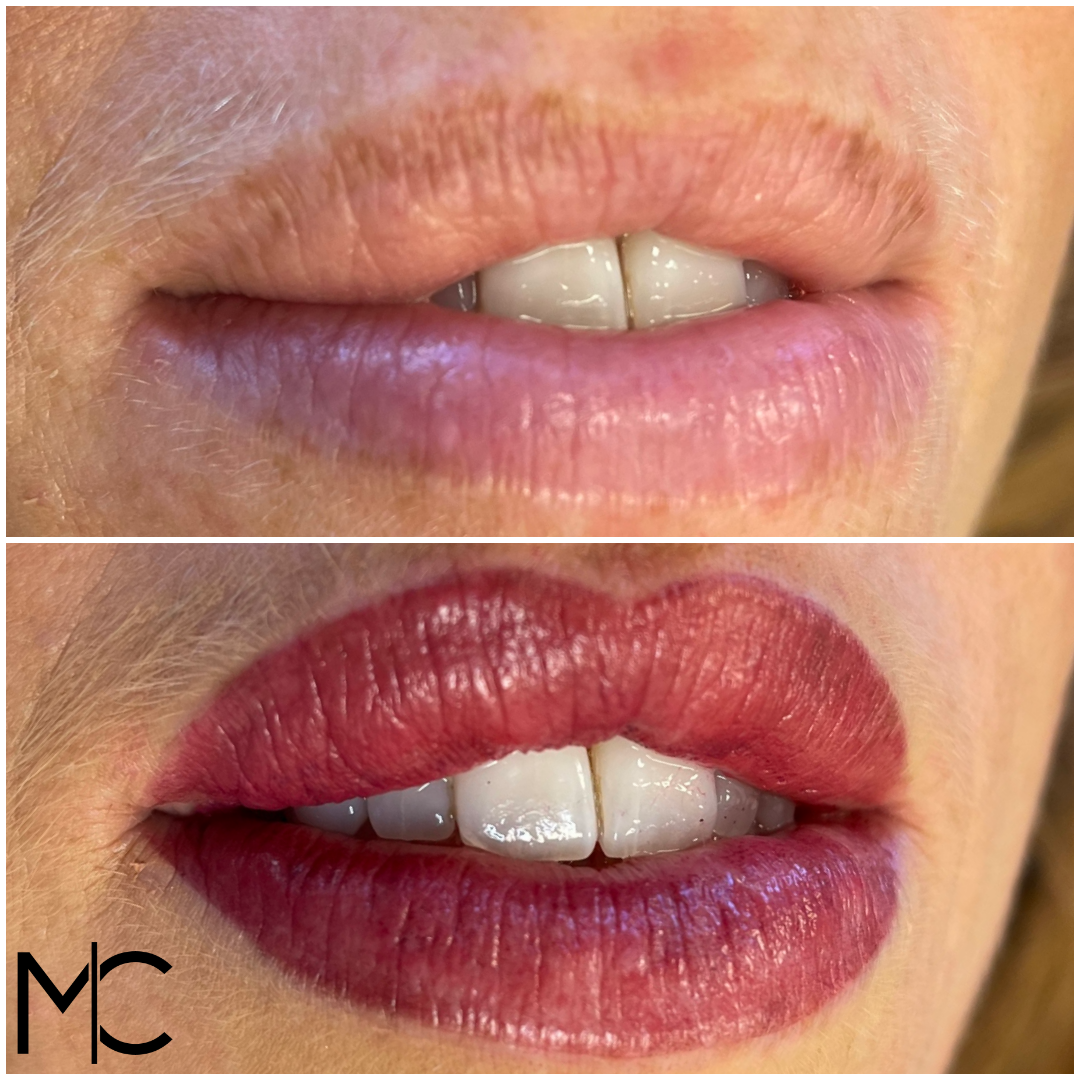 Lips