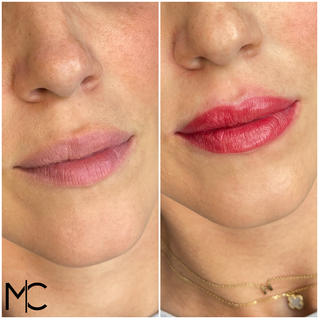 Lips