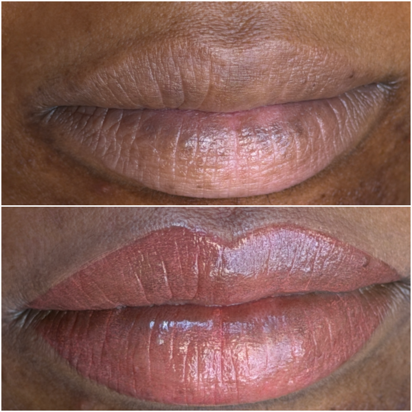 Dark Lip Neutralization by Lina